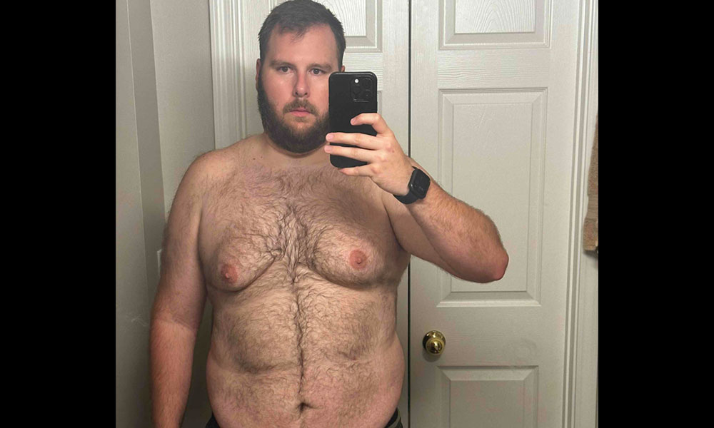 Before Transformation 2