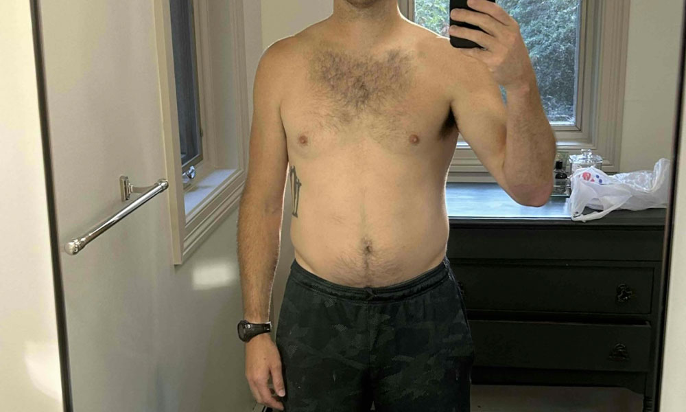 Before Transformation 5